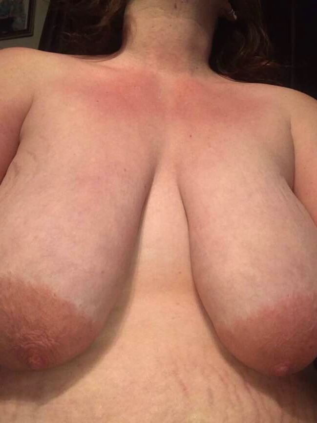 Fat jemma