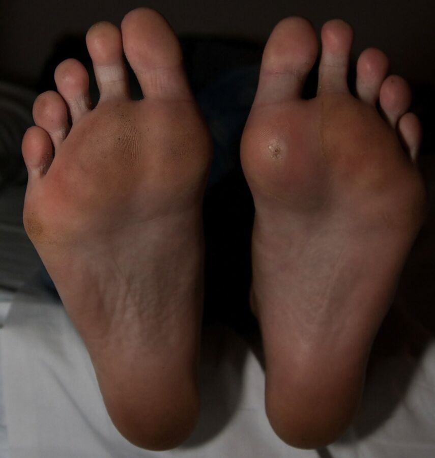 SL Dirty feet Fight