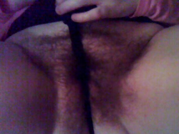 Hairy Anne