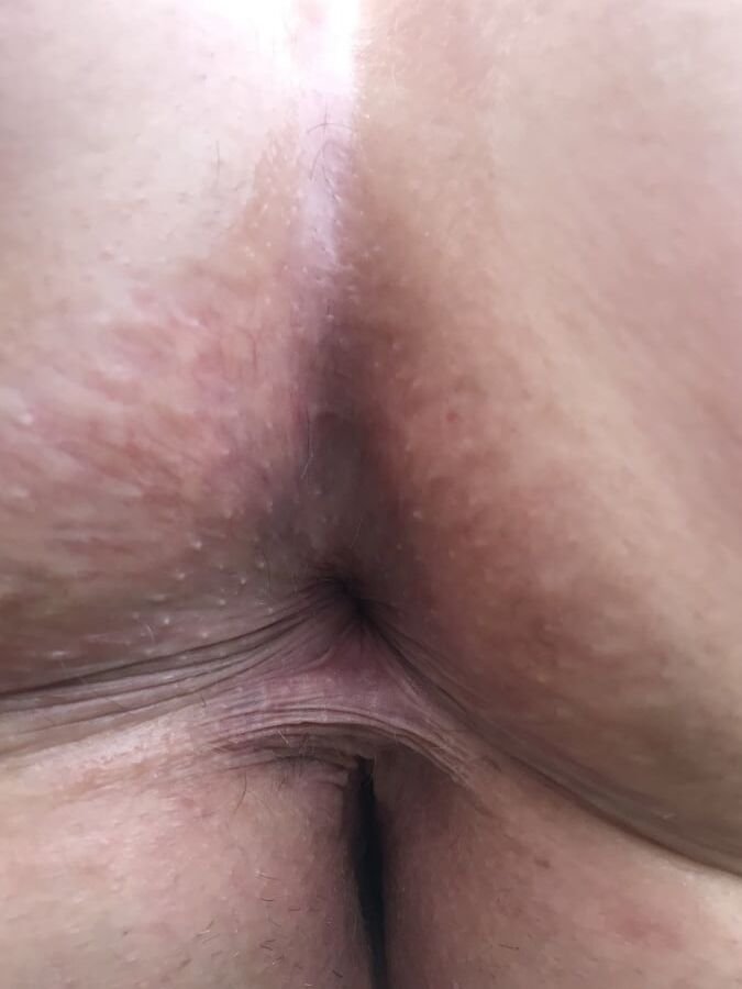 Fat jemma