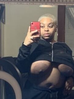 Baldhead Scally Wag