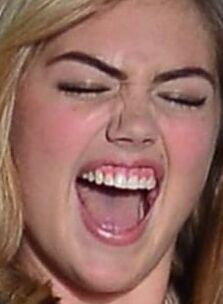 KATE UPTON