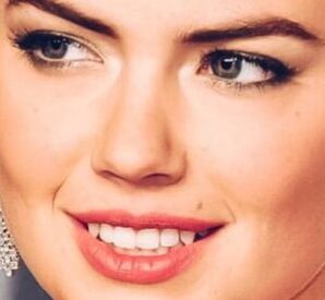 KATE UPTON