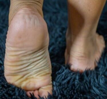 Arab wife wrinkled soles