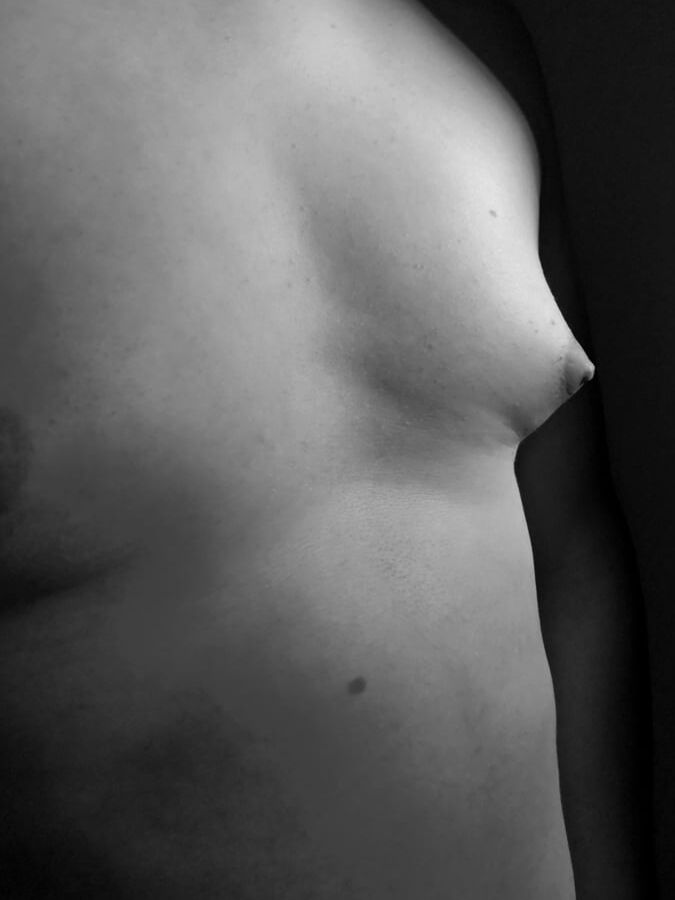 my fat body