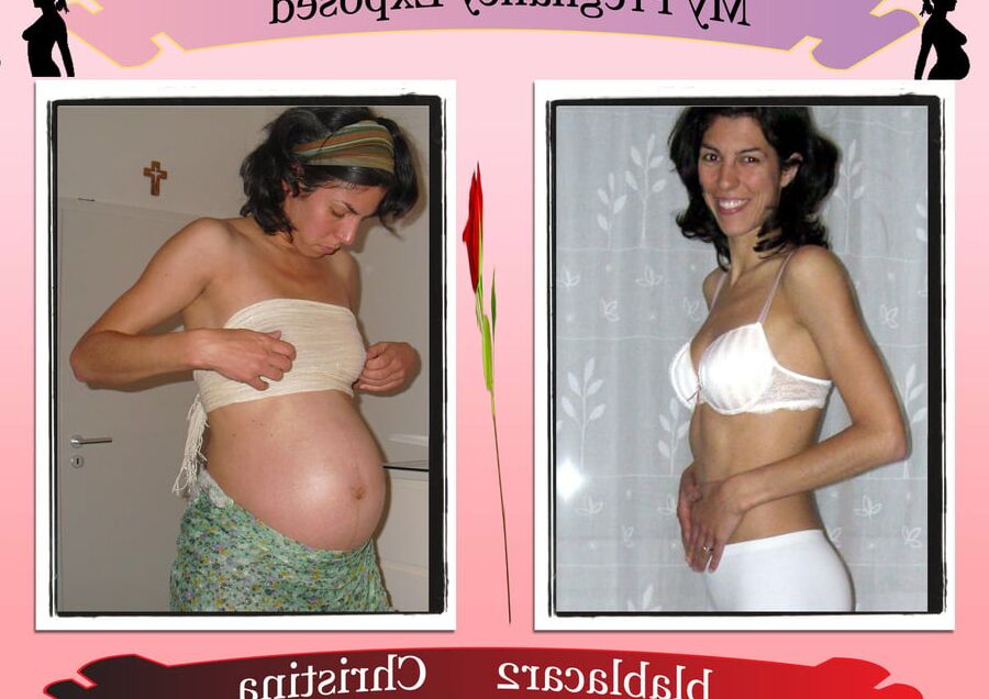 Pregnant Exposure Posters
