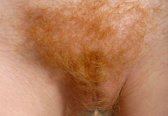 Redhead pussies