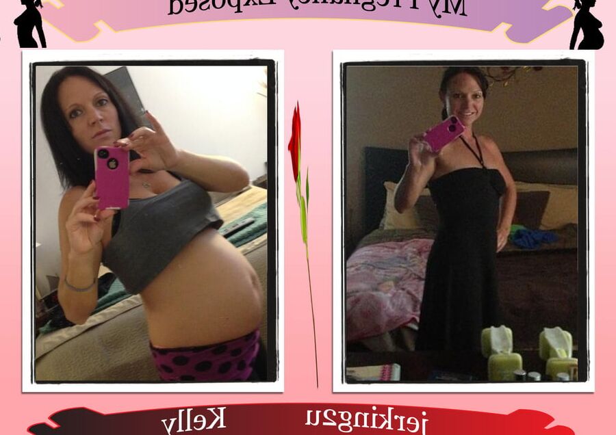 Pregnant Exposure Posters