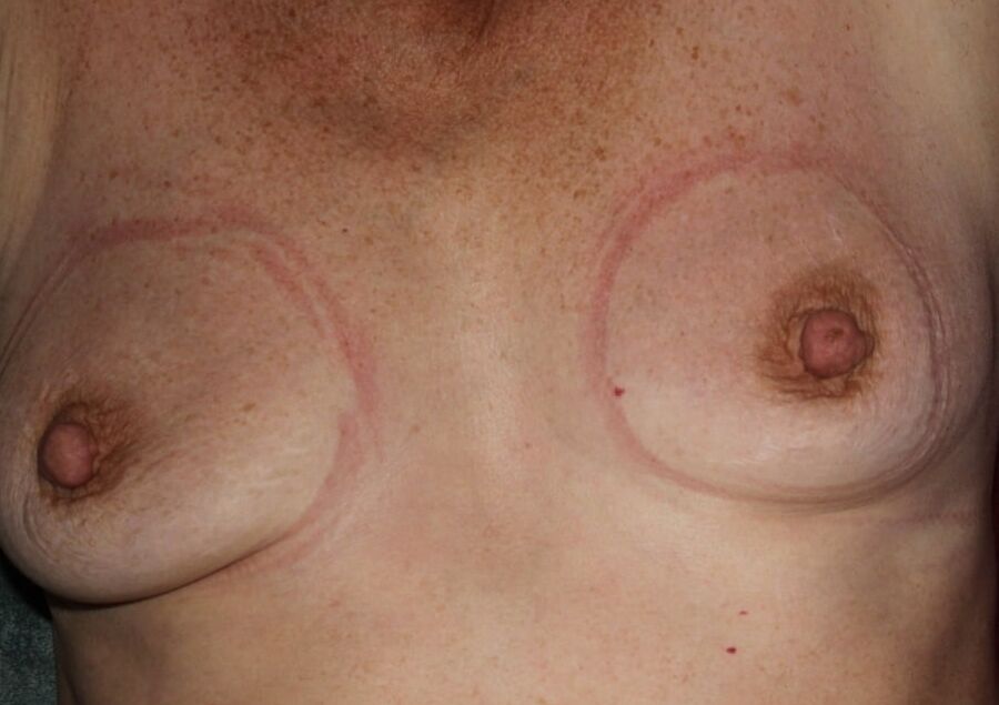 Wife&;s Tits