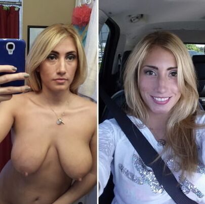 Before and After