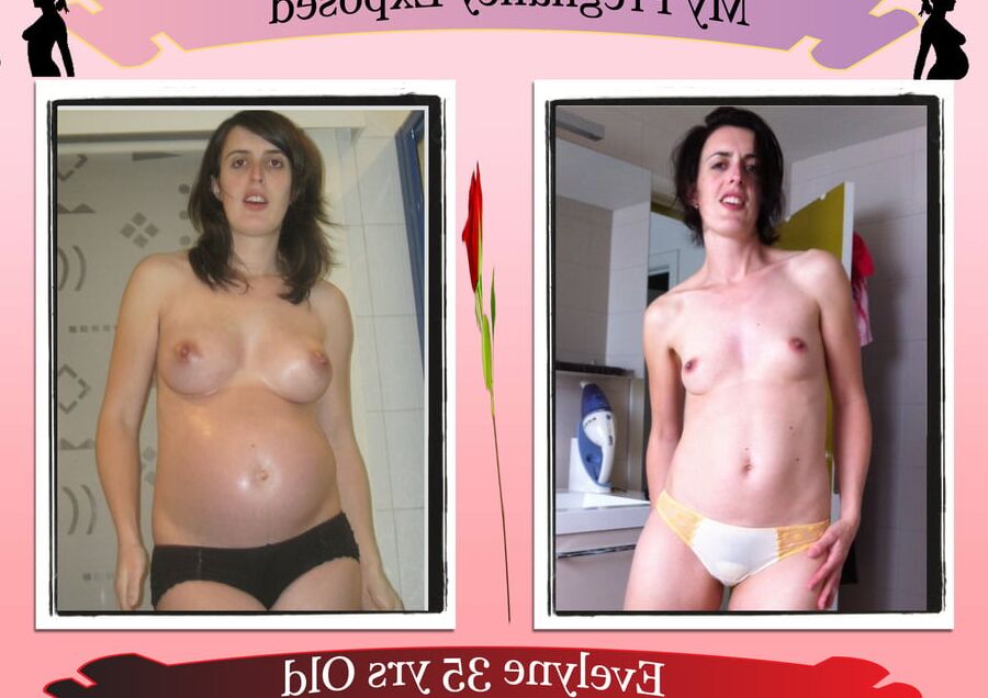 Pregnant Exposure Posters