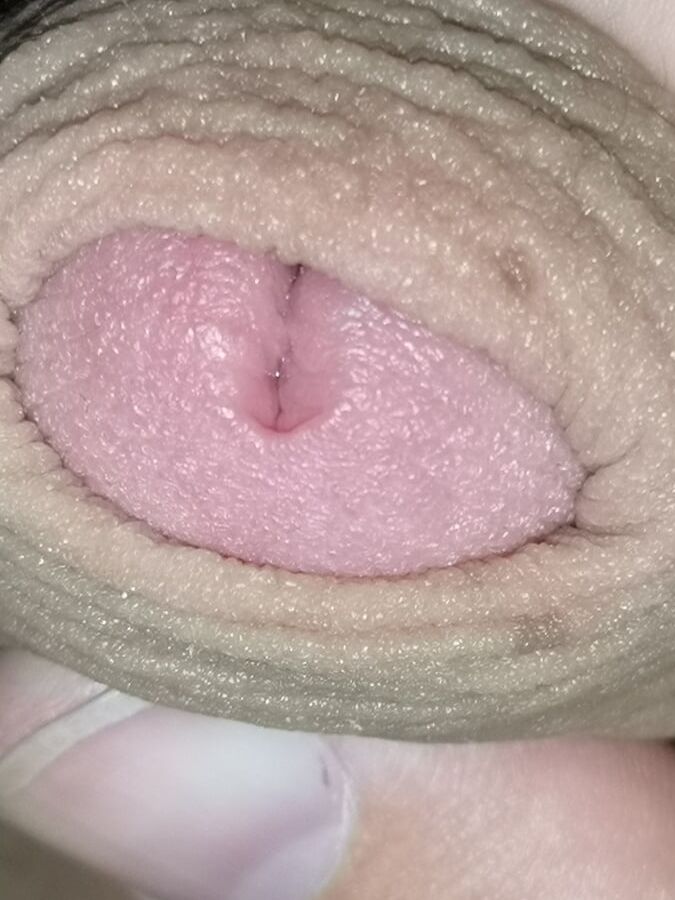 my fat body