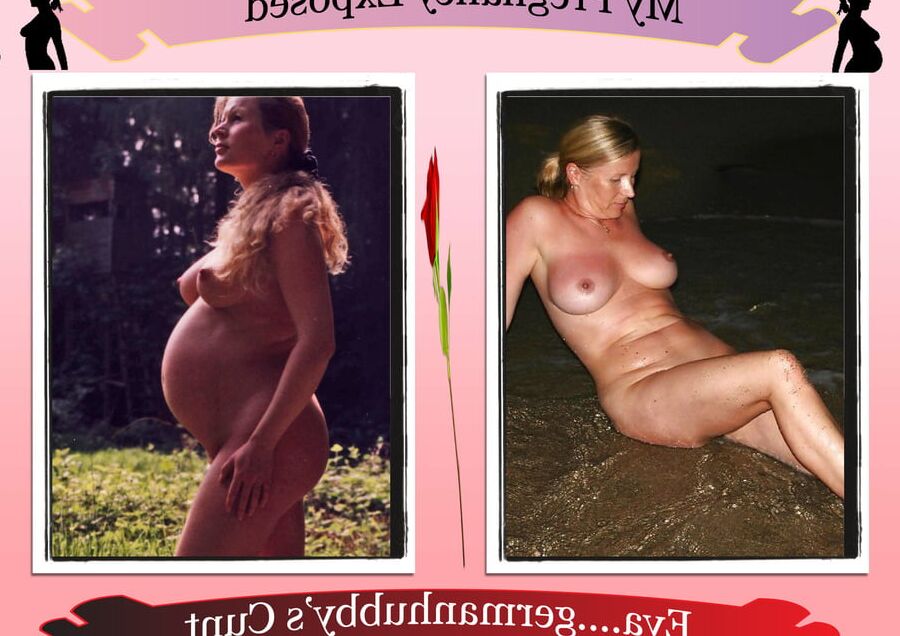 Pregnant Exposure Posters