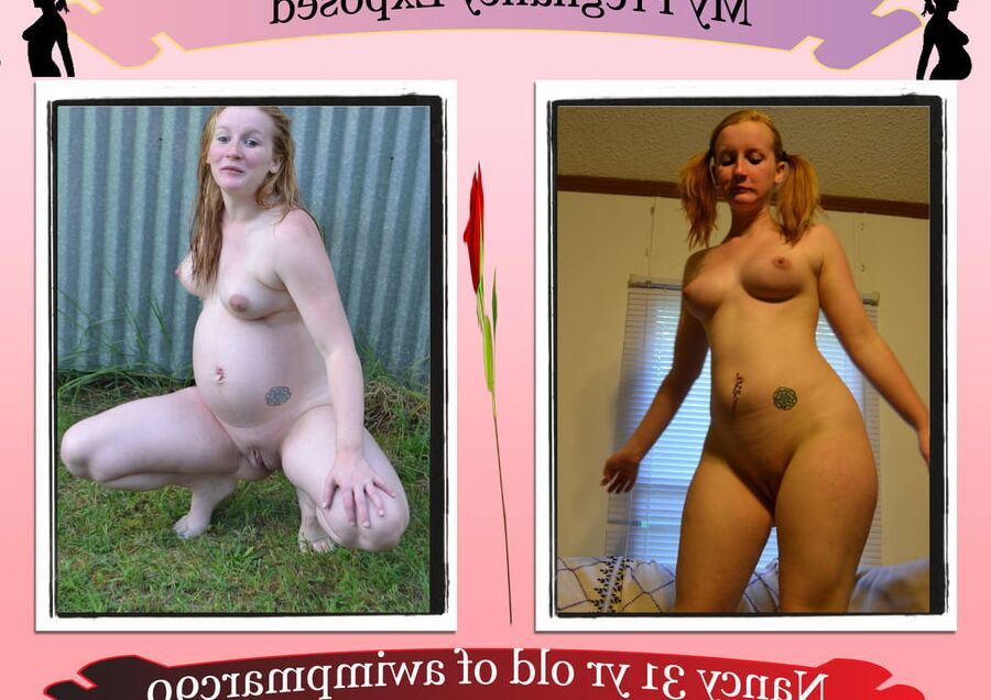 Pregnant Exposure Posters