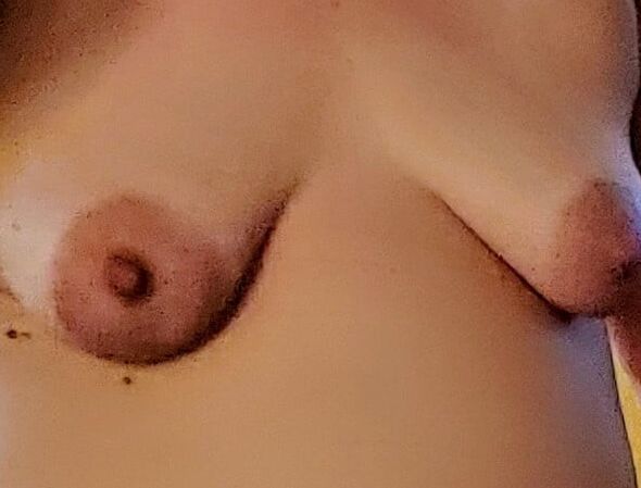 Saggy bbw tits