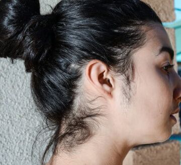 beauty with hairy body