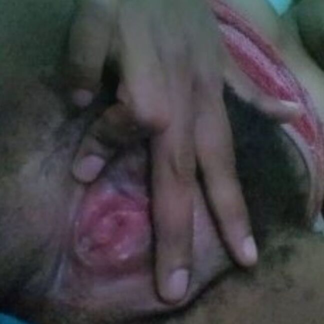 PNG Shaline hairy Tolai