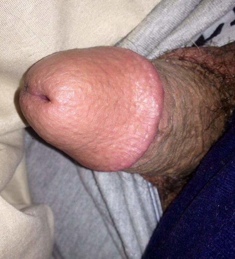 Public