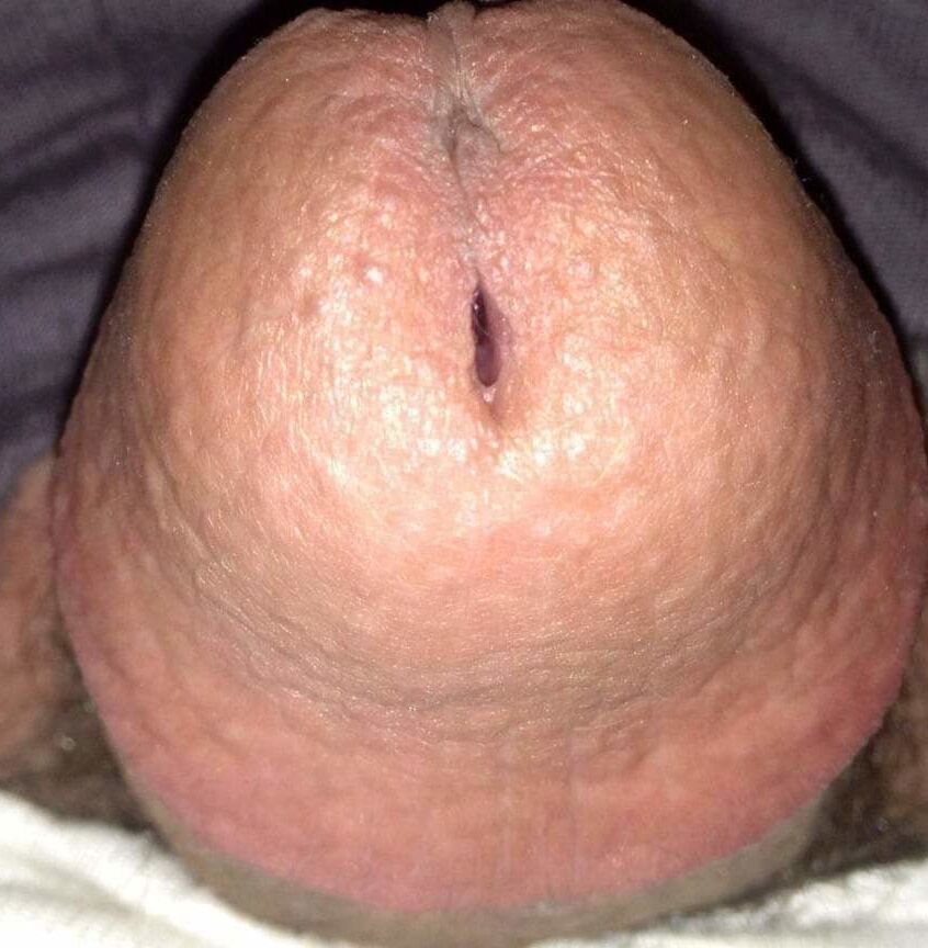 Public