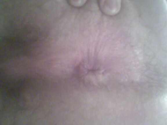 My Ass Hole