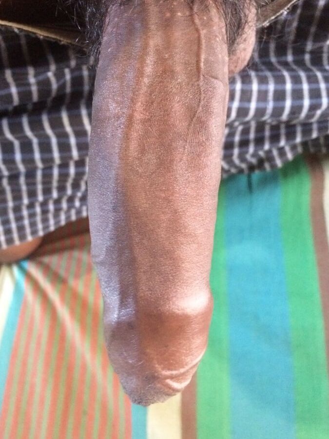Tool to treat