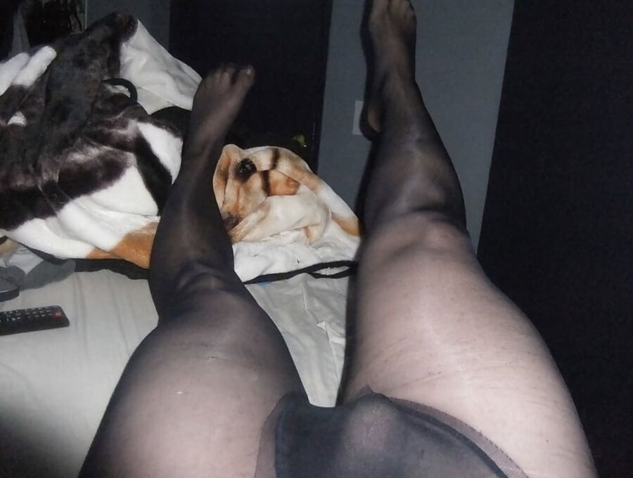Legs