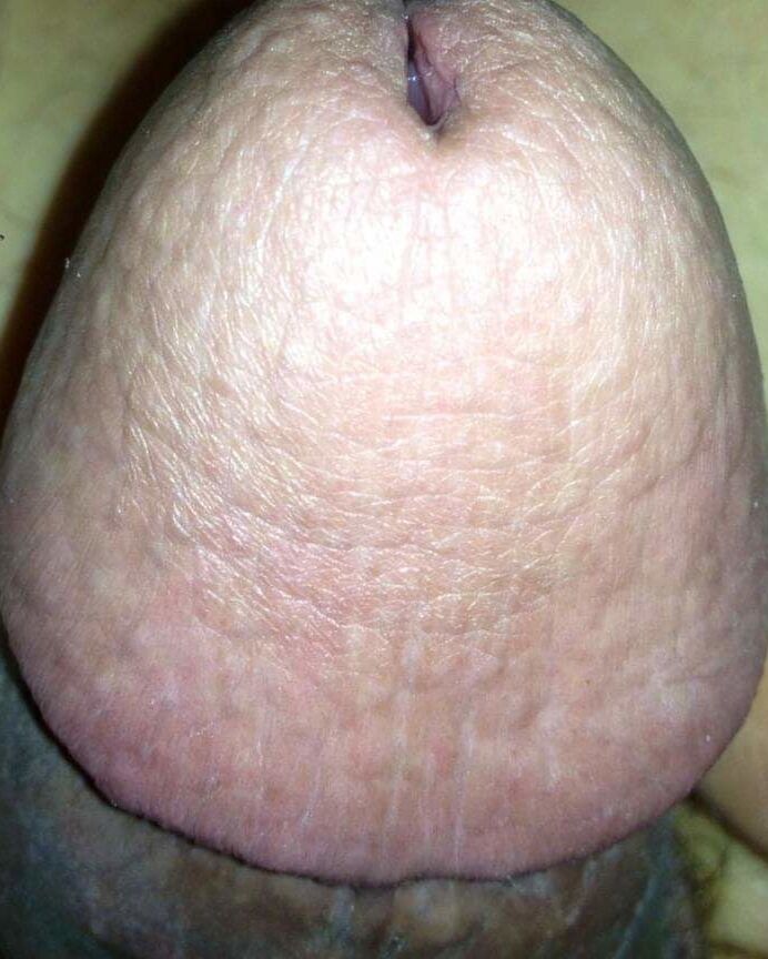 Public