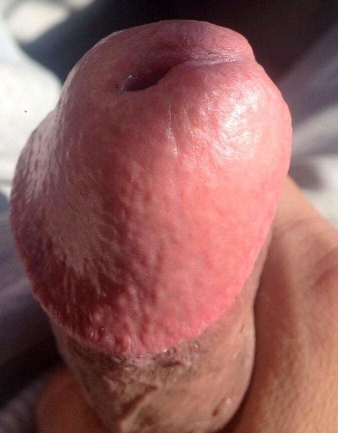 Public