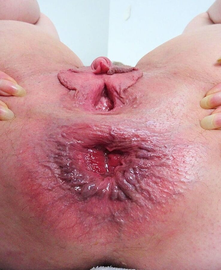 Holes of ass