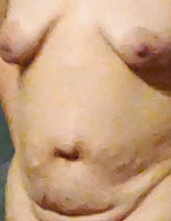 Saggy bbw tits