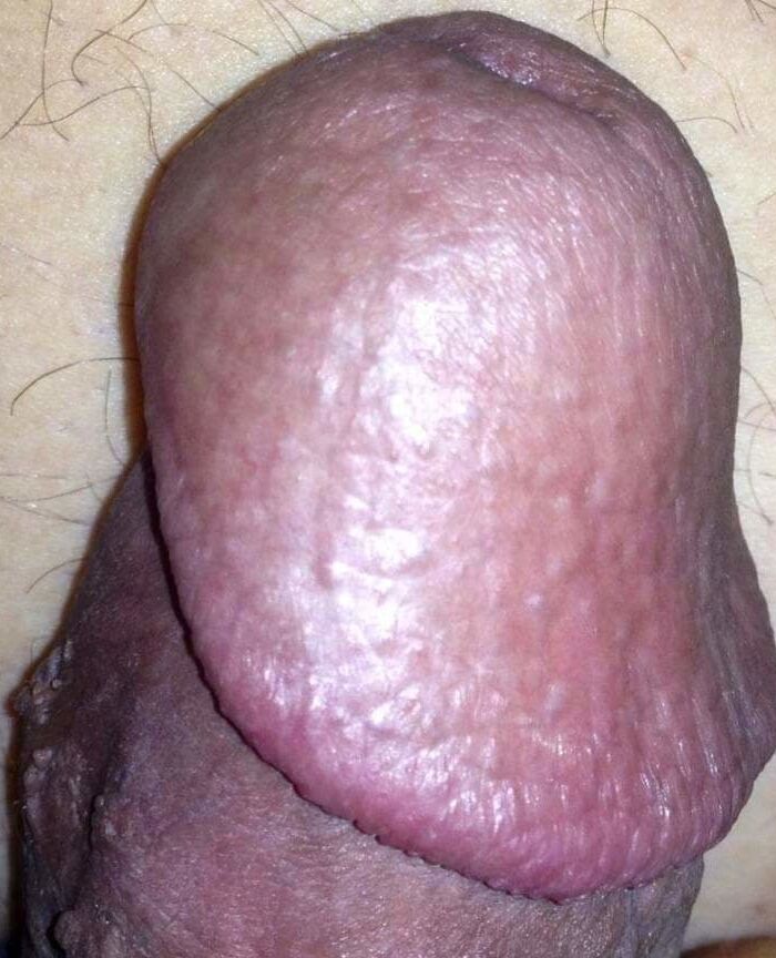 Public