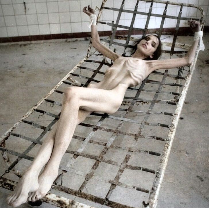 Anorexic-Cunts
