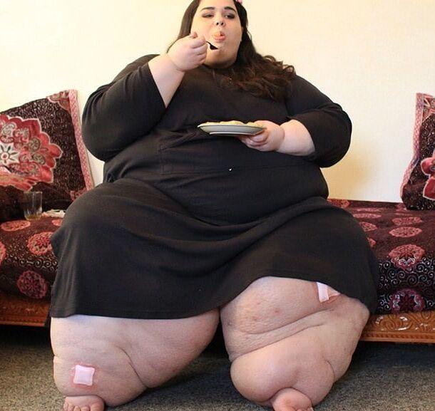 Nothing But Obese Legs