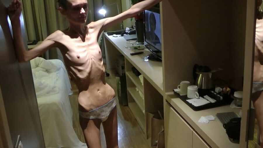 Anorexic-Cunts