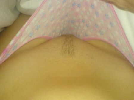 Bkini pussy mound