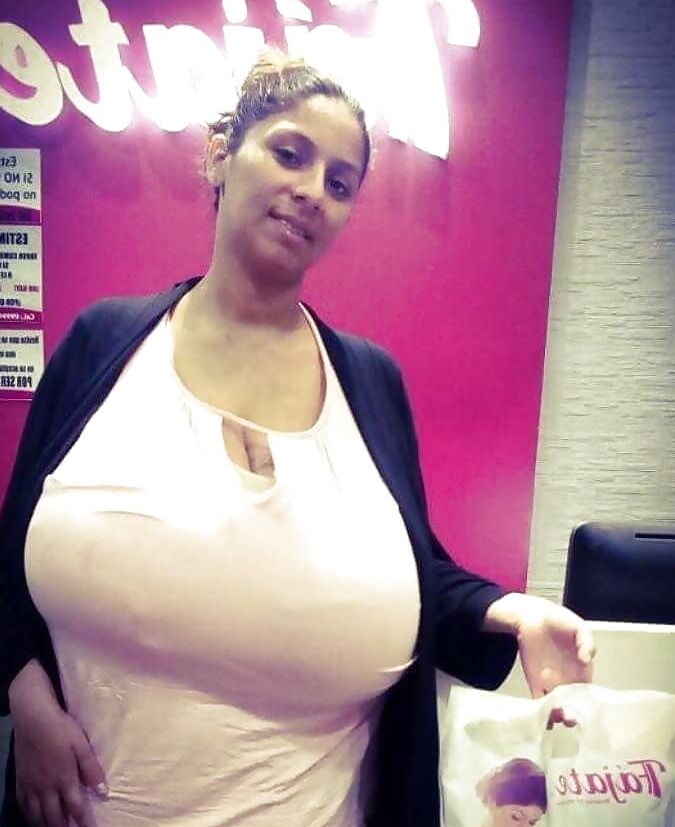 Massive Tits Breast Reduction