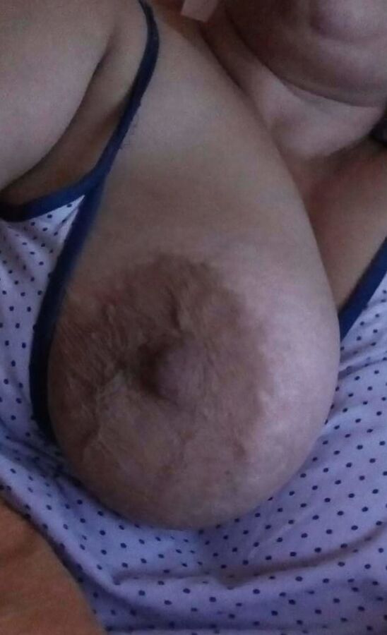 Bbw Breast