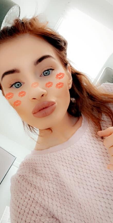 lip filer top up