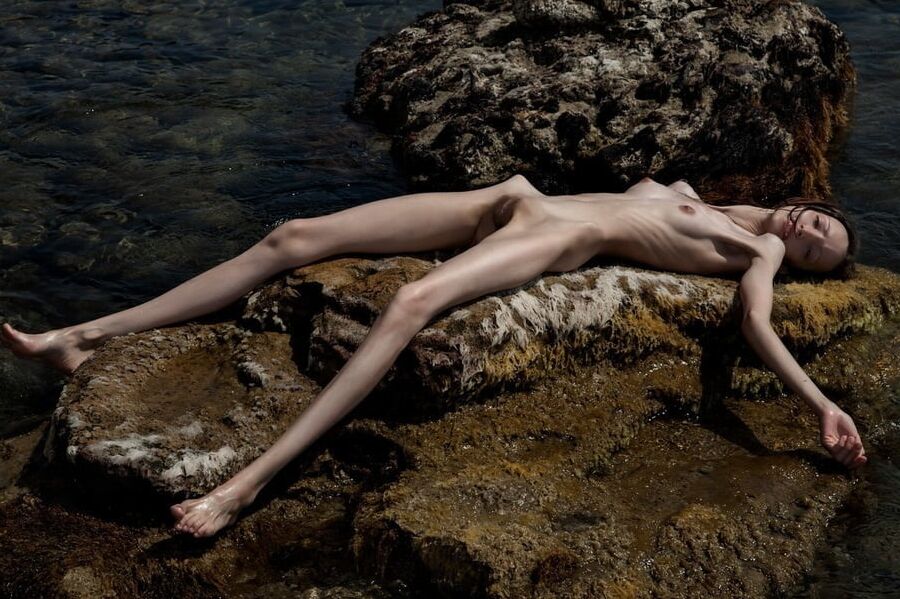 Anorexic-Cunts