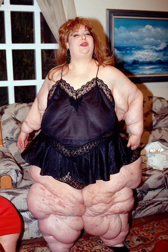 Nothing But Obese Legs