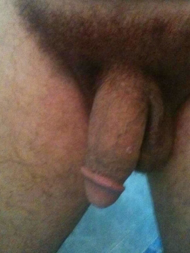 Hairy beach