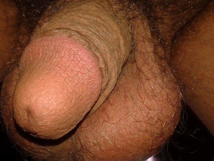 Hairy beach