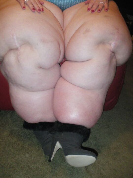 Nothing But Obese Legs
