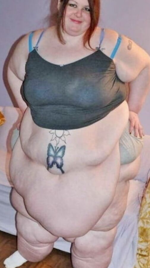 Nothing But Obese Legs