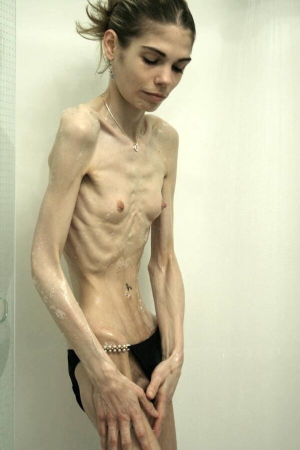 Anorexic-Cunts