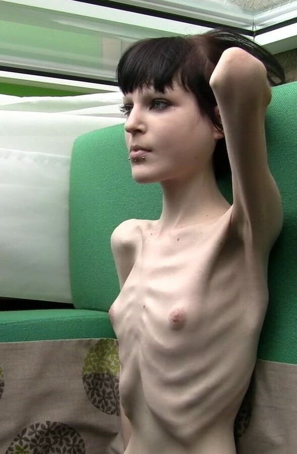 Anorexic-Cunts