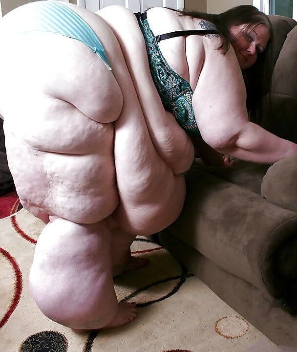 Nothing But Obese Legs