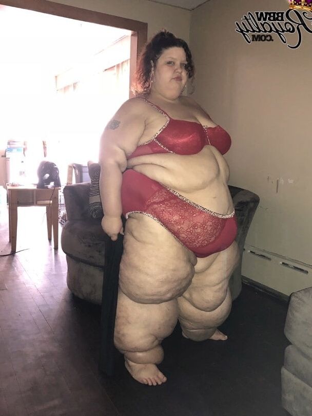 Nothing But Obese Legs