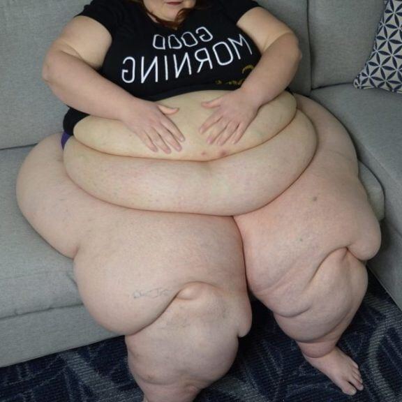 Nothing But Obese Legs