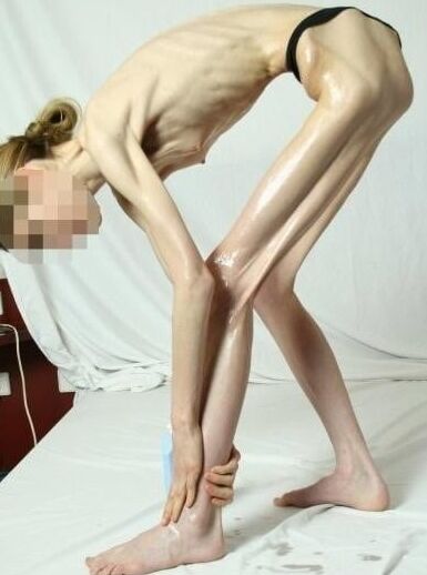 Anorexic-Cunts
